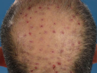 Case van de week Case van de week