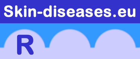 To homepage www.skin-diseases.eu Skin-diseases.eu